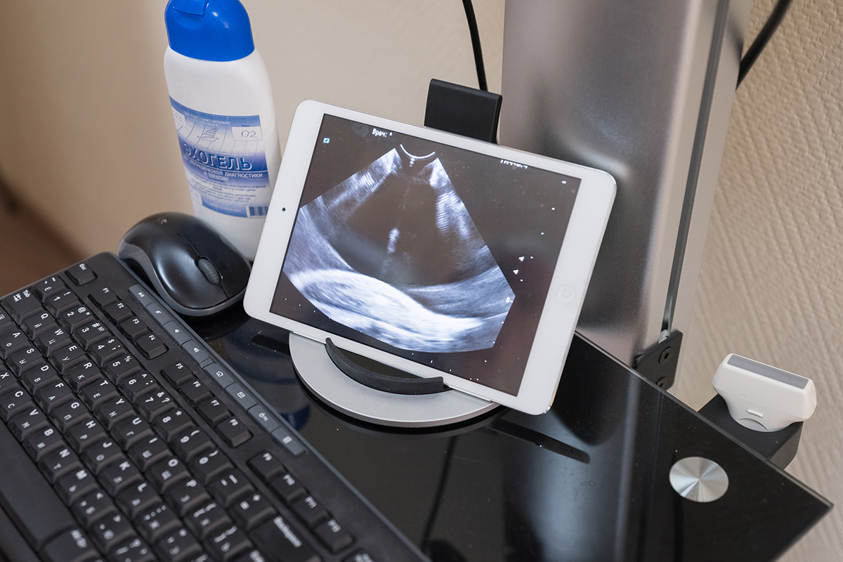 Unique equipment for ultrasound examination